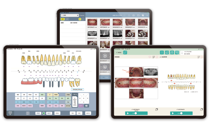 Dental XR screen