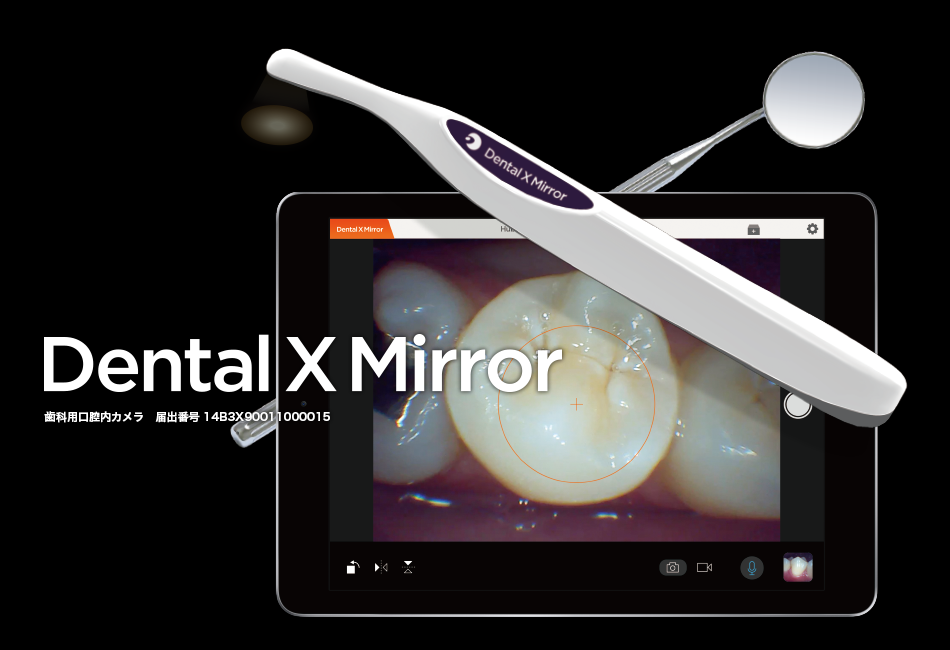 DentalX Mirror